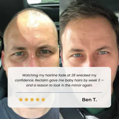 Hair Growth Roll-On Serum